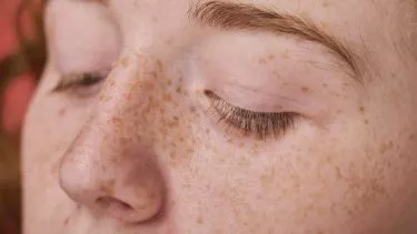 Closeup af rødhårets ansigt med fregner, øjnene kigger ned
