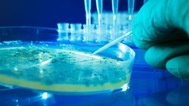 bakterier antibiotikaresistens proteiner dna rna transportproteiner