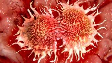 Kræft cancer malariavaccine sukker på overfladen bremse kræft