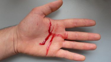 blod hånd farve blodig bløder hæmoglobin
