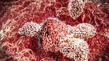 kræft immunterapi