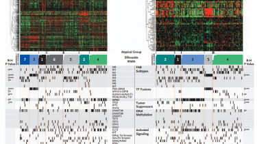 cytogenic_risk_risiko_genom_aml_gener_genetik_dna