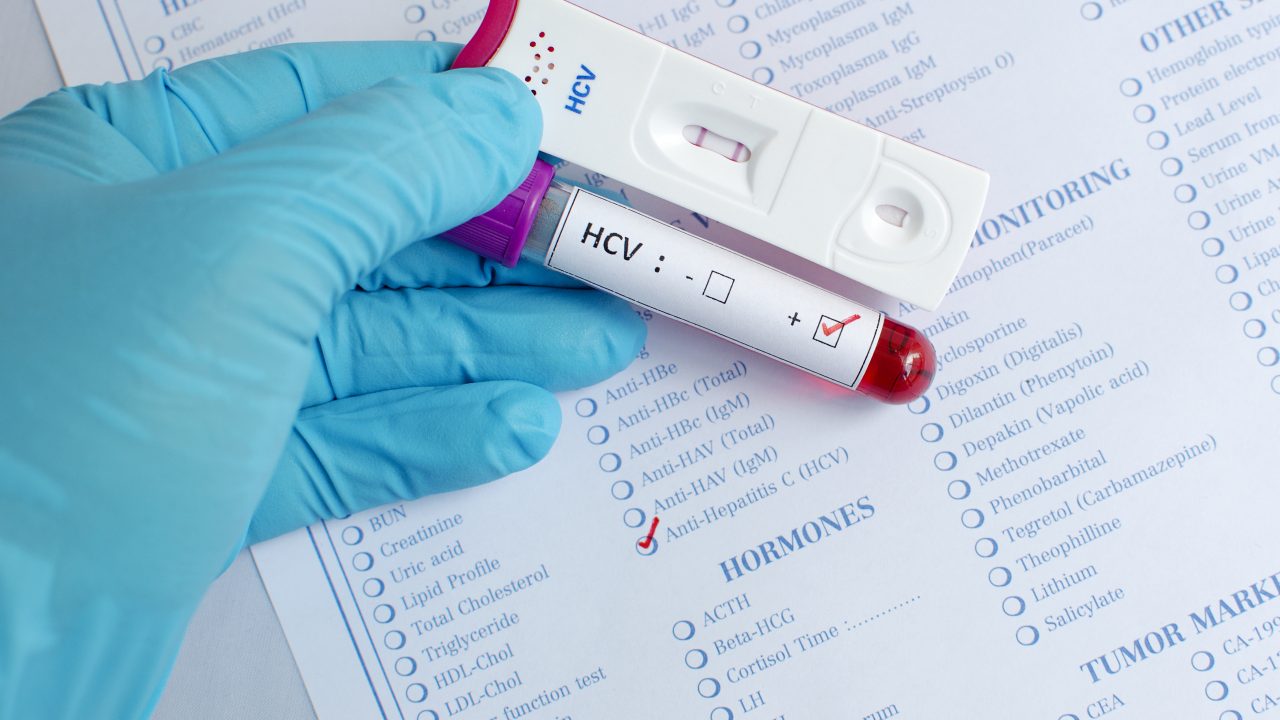 medicin hepatitis C videnskab blog hokland læge