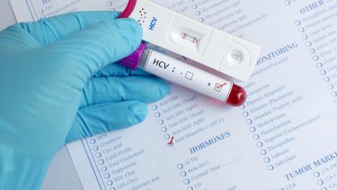 medicin hepatitis C videnskab blog hokland læge