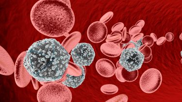 HIV AIDS kur mod hiv romidepsin