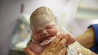 Baby traume traumatisk fødsel mor psykiske men fysisk