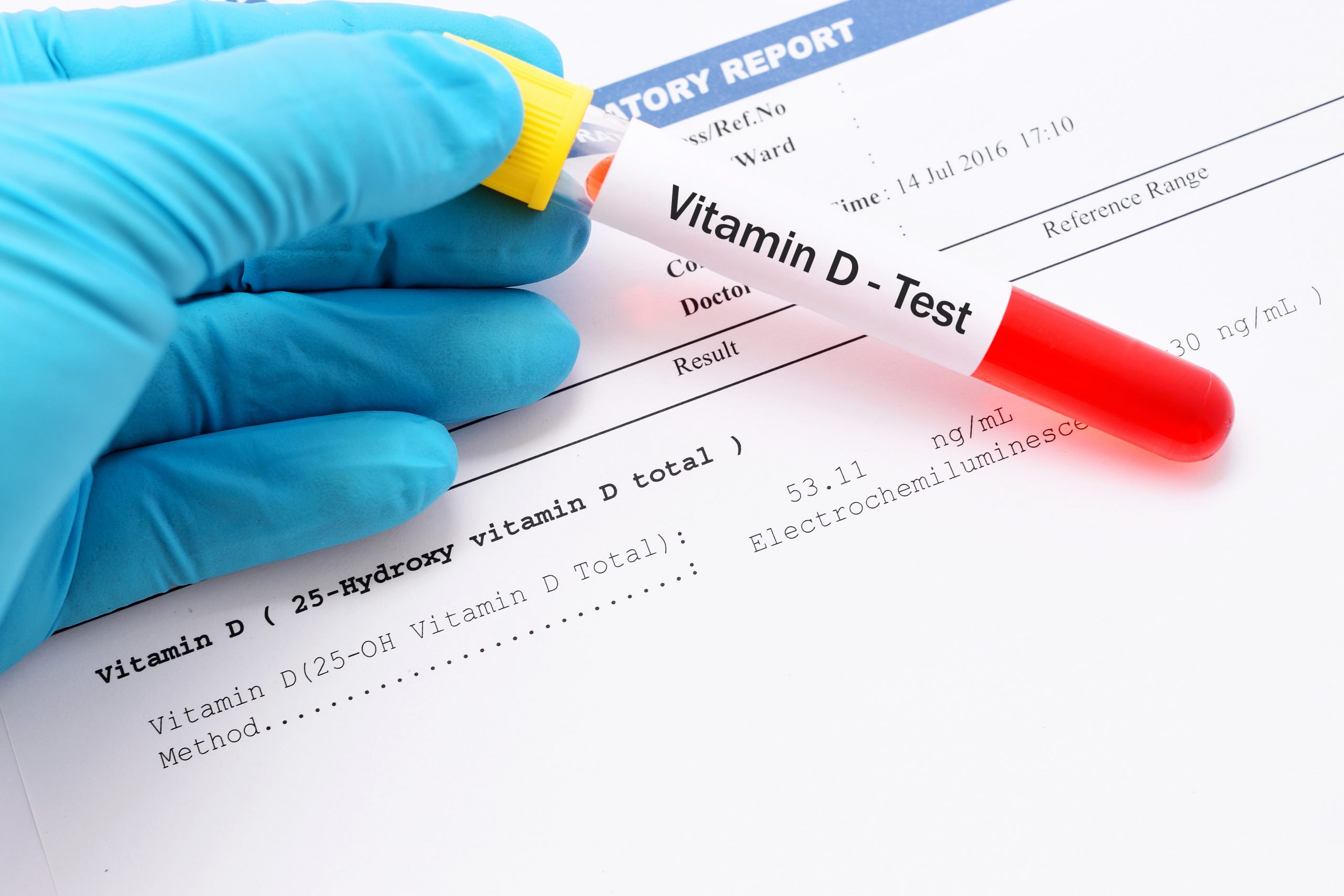 d-vitamin vitaminmangel test kost vitaminpiller