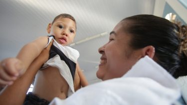 microcephaly udviklingsdefekt baby børn zika virus neurologisk kraniehvælving