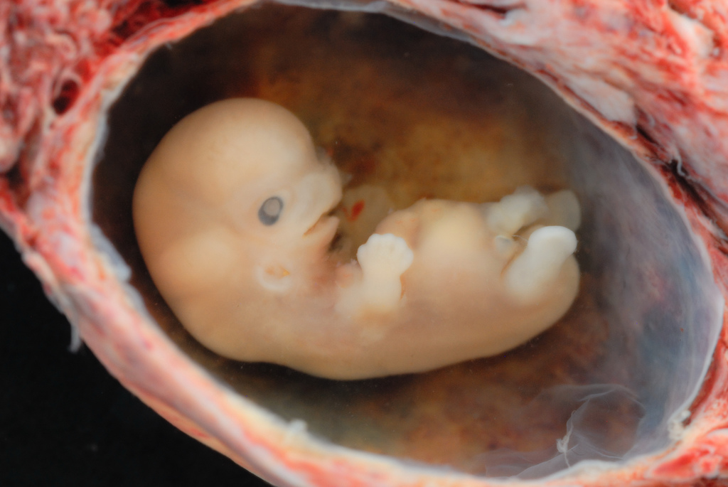 CRISPR teknologi gen genredigering menneske embryo forskning gennembrud videnskab etik fertilitetsbehandling Kina USA etik lovgivning mutation arvemasse sygdom arvelig