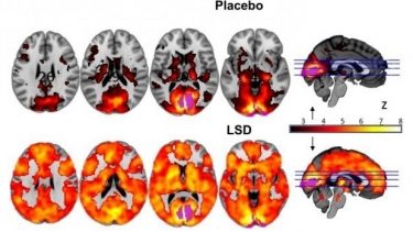 Det er særligt hjernens synscentre, der kommer på overarbejde, når du tager LSD. Det kan måske forklare de stærke hallucinationer, som stoffet er forbundet med, fortæller britiske forskere. (Illustration: Imperial College London)