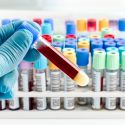 antibiotika clarithromycin biologisk forklaring overdødelighed