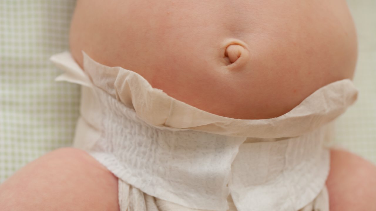 navle navlestreng livmoder fødsel forbundet moder baby foster barn udvikling moderkage blodtilførsel navlevene navlestrengsvæv Whartons gelé blæredeler urinledere kirurgi ligament kroppen