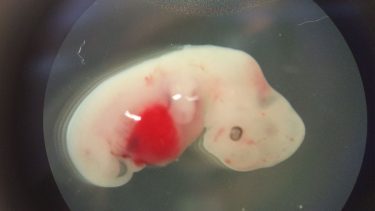 menneske får hybrid genetik