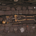 middelalder kistefødsel hjerneoperation trepanering