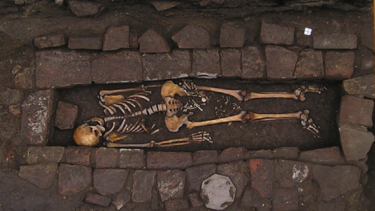 middelalder kistefødsel hjerneoperation trepanering