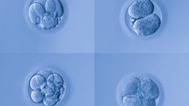 celle celledeling befrugtet æg gener mutationer arvemateriale DNA mRNA molekyler embryo kortlægning genfejl specialisering ophav dyr planter mennesker stamceller udvikling celleprocesser