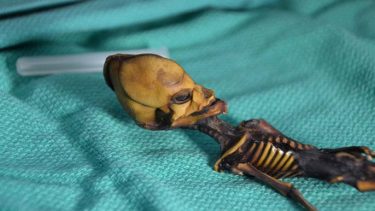 alien skelet undersøgelse menneske forskning bag om dna