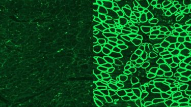CRISPR  Duchennes muskeldystrofi hvalpe respiration hjertefunktion teknologi gen genredigering menneske forskning gennembrud mutation arvemasse sygdom arvelig