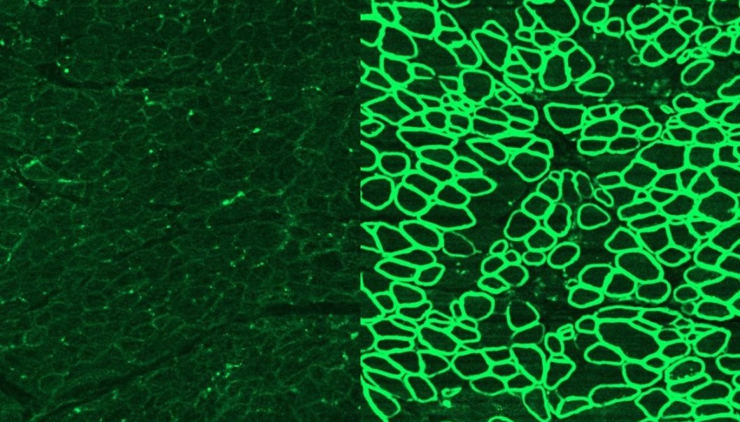CRISPR Duchennes muskeldystrofi hvalpe respiration hjertefunktion teknologi gen genredigering menneske forskning gennembrud mutation arvemasse sygdom arvelig