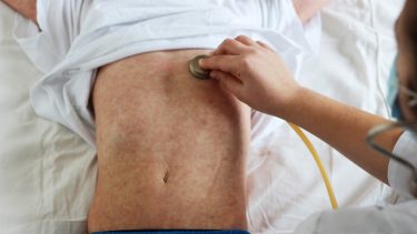mæslinger kræft sammenhæng forebyggelse vacciner evidens