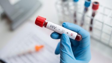 Hiv kur