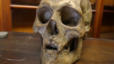 robert_the_bruce_kranie_spedalskhed
