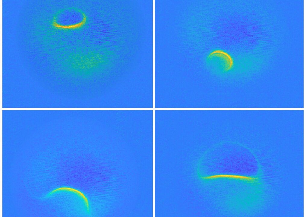 Atomer fanget på MR-scanning