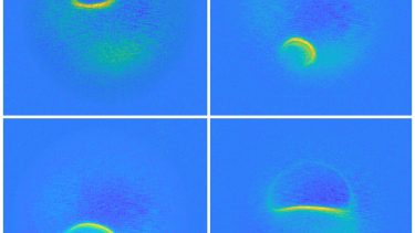 Atomer fanget på MR-scanning