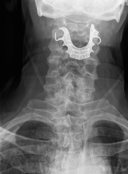 gebis mand sluge BMJ