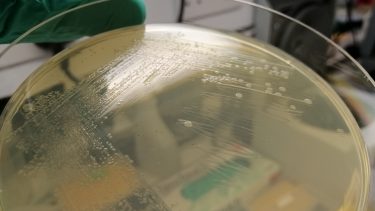 Genom arvemasse bakterier organismer bioteknologi