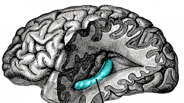 hippocampus epilepsi behandling hjernen
