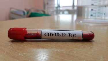 hvad sker der hvis coronavirus muterer kan dødelighed farlig