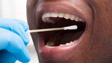 COVID-19 corona sygdom smitte epidemi pandemi udbredelse udbrud global spredning Verdenssundhedsorganisationen risiko epidemiolog Real-Time Reverse Transcription Polymerase Chain Reaction vaccine behandling