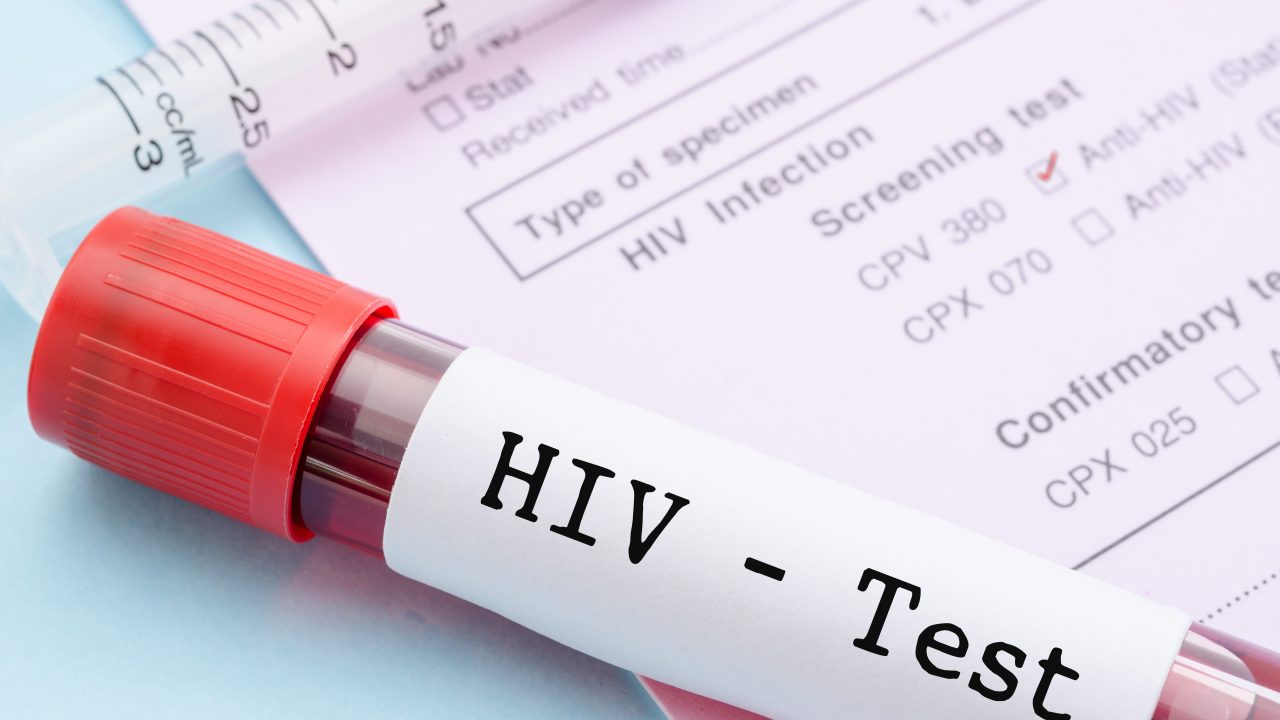 Rask for HIV virus
