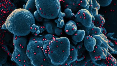 1_sars-cov-2_coronavirus_foto_niaid-rml