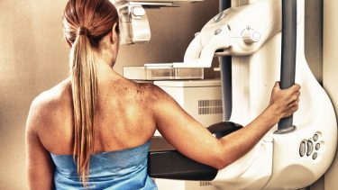 mammografi screening brystkræftscreening selektionsbias brystkræft cancer