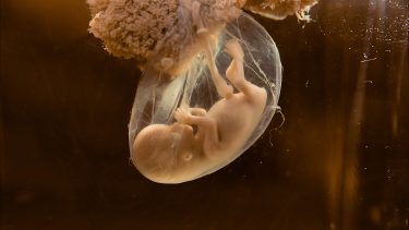 Embryologi_foster_udvikling_graviditet