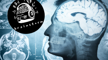 brainstorm ny hjerne podcast videnskabdk