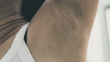 sved armhule stafylokok lugt bakterie