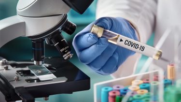 COVID-19 corona sygdom smitte bakterier RNA DNA virale protein genetisk vilde dyr får antistoffer epidemi pandemi udbredelse udbrud global spredning vaccine behandling