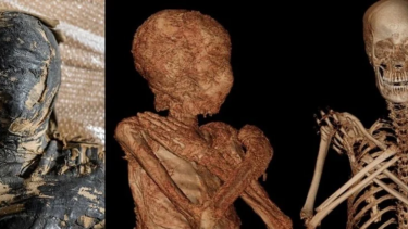 mumie gravid første baby