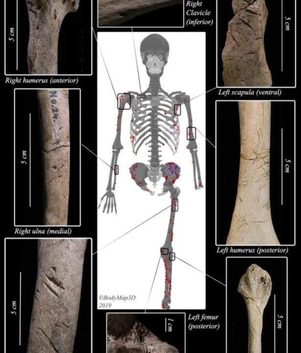 Hajangreb 3000 år siden Japan Mand
