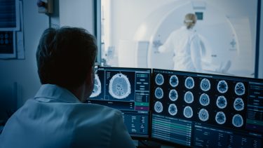 forsker mri scanning billeder
