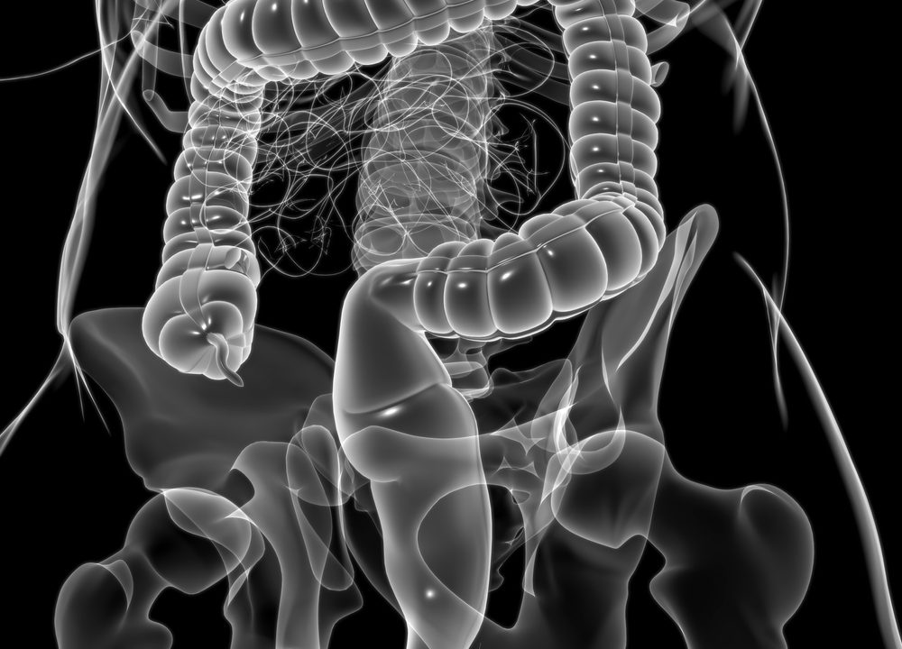 Antibiotika tarmkræft tarmflora ændringer sygdomme bakteriesamfund