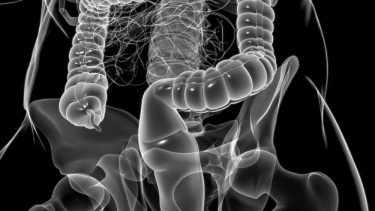Antibiotika tarmkræft tarmflora ændringer sygdomme bakteriesamfund