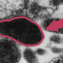 Mycoplasma