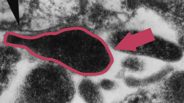 Mycoplasma