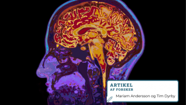 aksoner_hjernesygdomme_mrscanning_røntgen_xray_diagnose_alzheimers_hjerneforskning_kurmoddemens_demens_hjernen