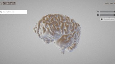 neurotorium_hjernen_hjerneatlas_skanning_undervisning_hjerneforskning_hjernesygdomme