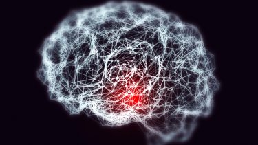 alzheimers